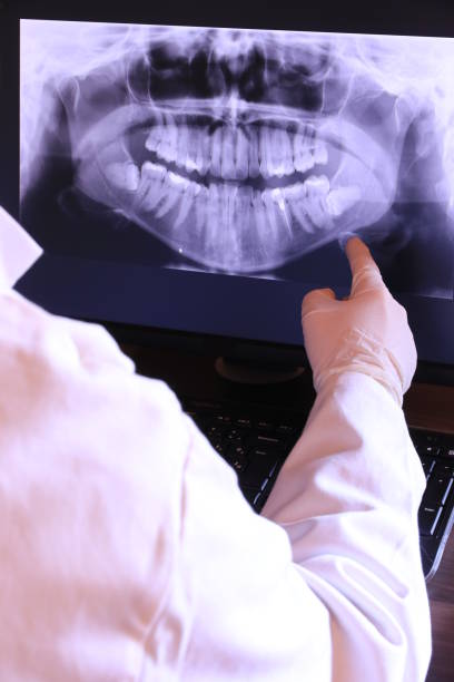 Best Emergency Treatment for Dental Infections or Abscesses in Grantsburg, WI