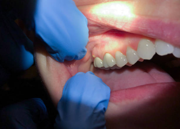 Best Weekend Emergency Dentist in Grantsburg, WI