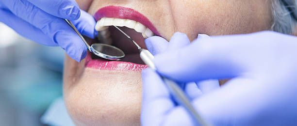 Best Urgent Care for Lost Fillings or Crowns in Grantsburg, WI